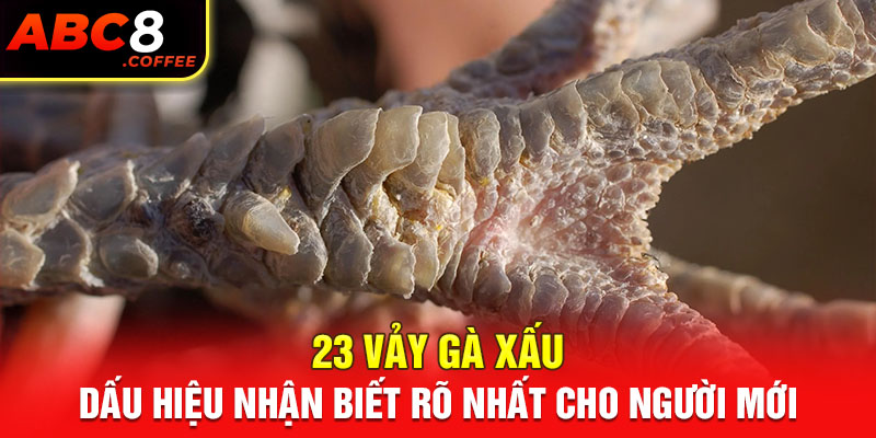 23 Vảy Gà Xấu - Dấu Hiệu Nhận Biết Rõ Nhất Cho Người Mới